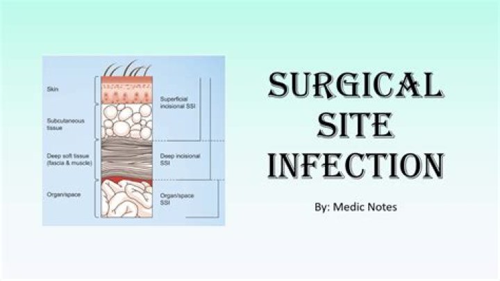 Can I get SSI at age 58?