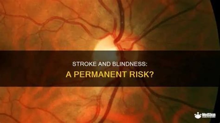 Is Blindness from stroke permanent?