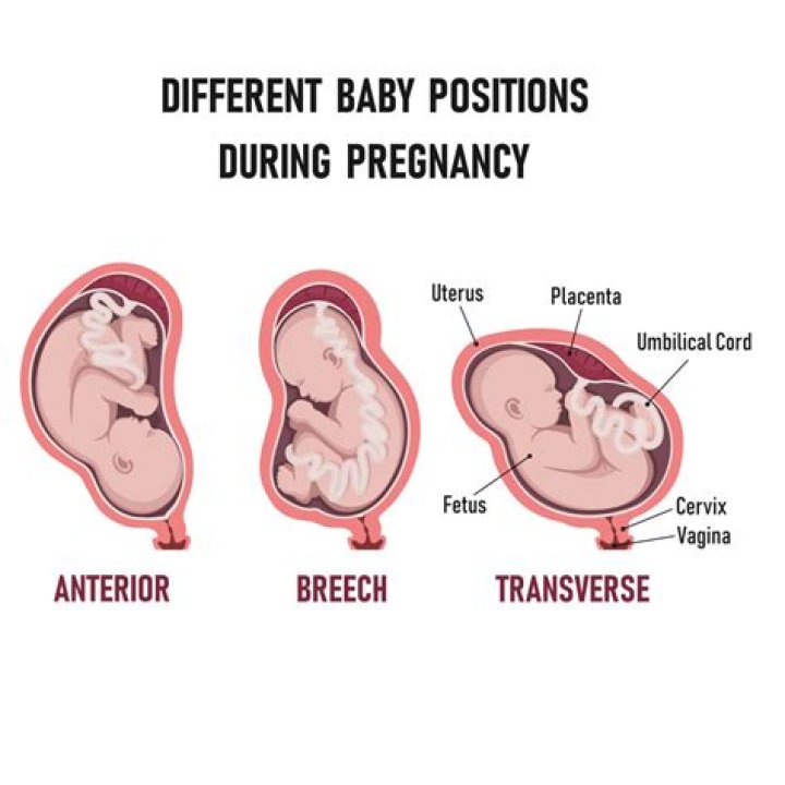 What is it called when a parent turns child against other?
